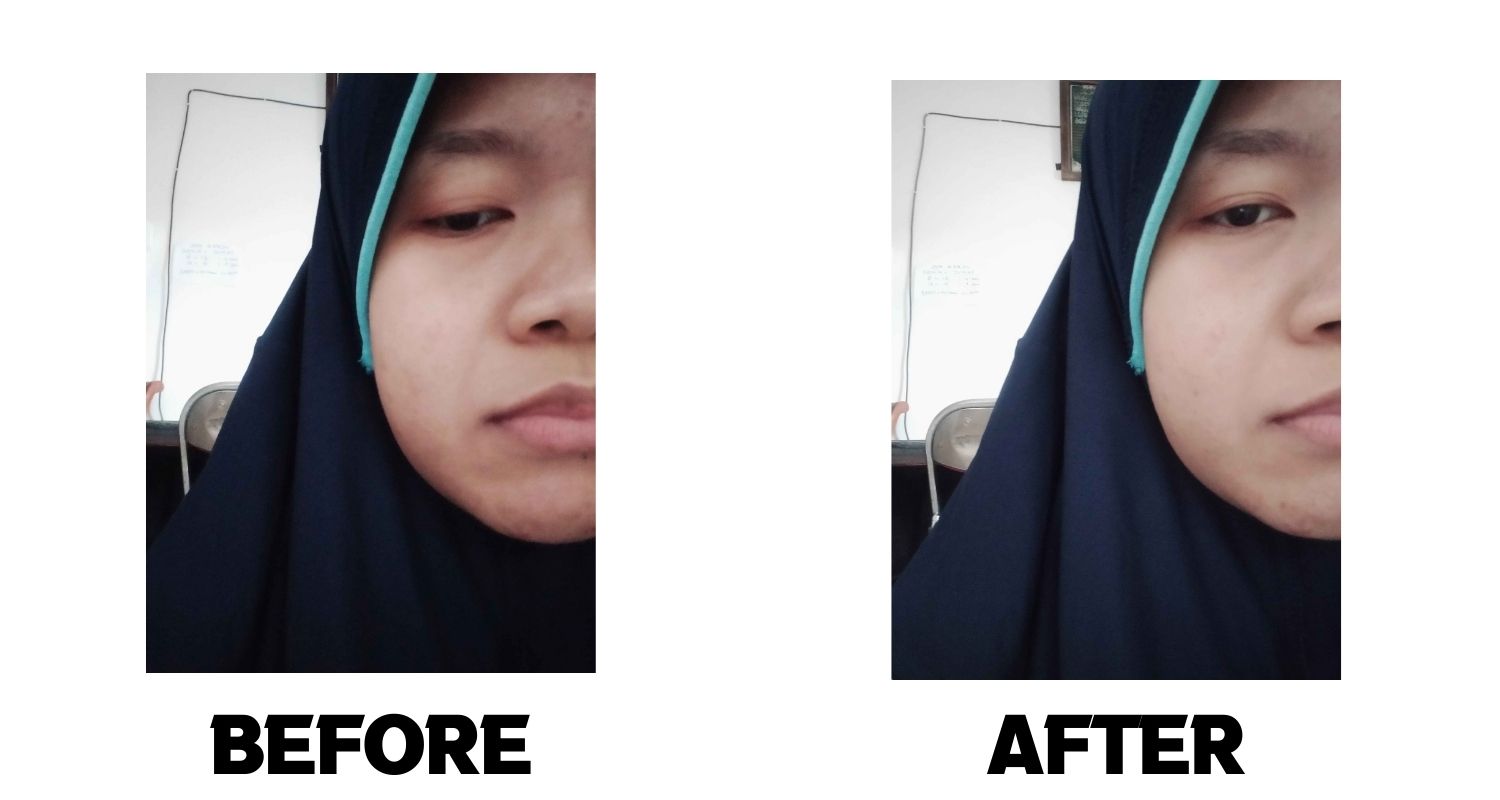 Before - After maresha green glow skincare